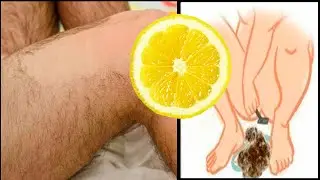 How To Get Rid Of Unwanted Hair | Remove Unwanted Hair With Lemon | Body Hair Removal Men