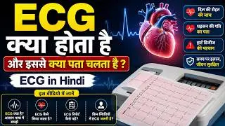ECG क्या होता है और इससे क्या पता चलता हैं ? ECG in Hindi