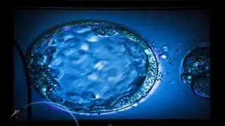 Sharing images of human embryo as seen through Babysure IVF microscope. Life in its truest sense.