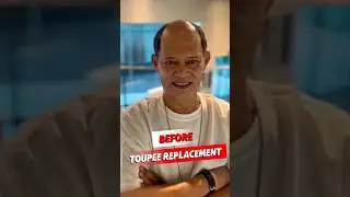 Top-Rated Human Hair Toupee 🔥 Real Results, Real Hair