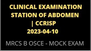 CLINICAL EXAMINATION STATION OF ABDOMEN | CCRISP