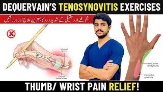 De Quervain’s Tenosynovitis Recovery | Wrist Pain Relief Exercises At Home