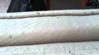 Bed bugs Columbus ohio