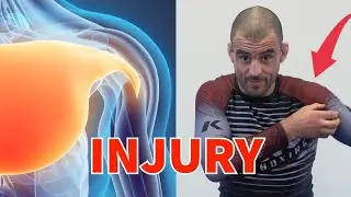 I Suffered a Major Injury!