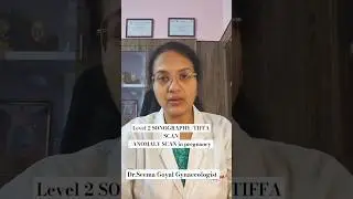 Level 2 sonography/ANOMALY SCAN/TIFFA SCAN  in pregnancy #doctor