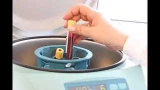 💉 Dlaczego lekarze zlecają CRP i OB jednocześnie, skoro jedno i drugie 