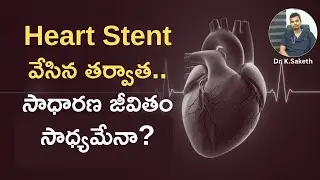 Heart Stent వేసిన తర్వాత.. సాధారణ జీవితం సాధ్యమేనా? | Dr.K Saketh |#shreemediahealth