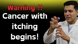 Itching in These Areas = 99% Cancer! If You Are Over 50 and Have This Itch, Watch This Video now!
