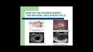 Chronic Pelvic Pain  Thinking Outside the Box 640x480 MP4