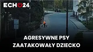 Agresywne psy zaatakowały dziecko