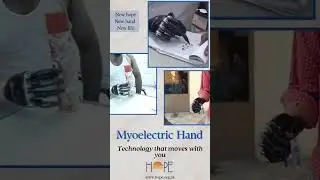 Myoelectric Hand technology