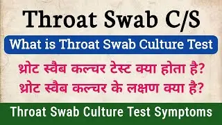 Throat Swab C/S Test in hindi | Symptoms of Throat Swab Culture
