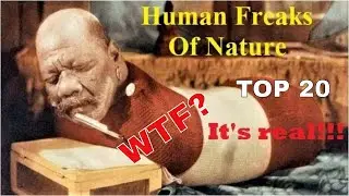 TOP 20 Amazing Real Life Human Freaks Of Nature.
