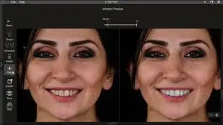 DTS PRO AI Detailed demo
