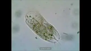 Stylonychia pustulata