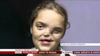 Photojournalist Jagwida Bronte talks to Karin Giannone on BBC World News