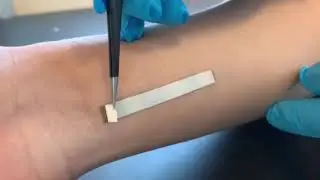 Transfer printing enabled OECT on skin