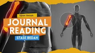Journal Reading - Optimal Treatment of Proximal Humeral Fractures in the Elderly