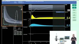 SmartPilot View Training &ndash; Time-to-Toss