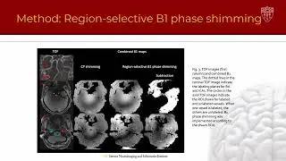 ISMRM 2022 - Improve super-selective ASL with pTx