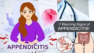 7 Warning Signs Your Appendix Might Burst Don&rsquo;t Ignore These!