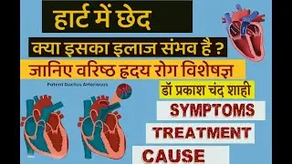 ventricular septal defect  | | दिल में छेद  (ASD , VSD, PDA)  Signs, & Symptoms |Symptoms of VSD |