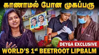 காணாமல் போன முகப்பரு | World's first Beetroot Lipbalm