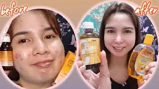 RDL BABYFACE SOLUTION #3 | before bedtime | my night routine