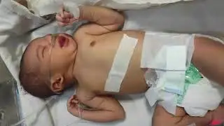 NEONATAL CARE TREATMENT IN NICU #treatment #nicu