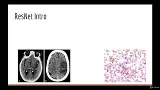 1  ResNet Section Intro