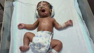  Oily Chest Physiotherapy & NG Tube Feeding for Breathing Support 🍼😢 #newborncare #feeding #nicubaby
