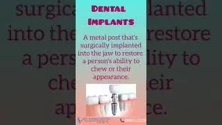 Options For Replacing Missing Teeth #srikirandental #dentist #denture #reels #trendingshorts