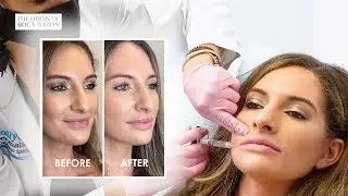 The Derms of Boca Raton | LIP FILLER NATURAL RESULTS | Episode 2