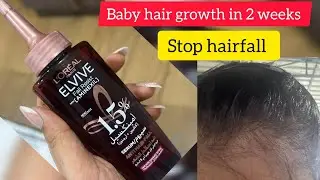 loreal elvive anti hair fall serum review in tamil #hairgrowth #hairfallsolution 