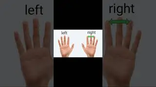 👉 Egawa&rsquo;s Sign &ndash; Quick Test for Ulnar Nerve Palsy #meded #physicalexam #handpain #physio #atc