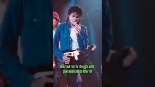 Michael Jackson Hairs Caught Fire.