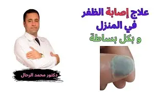 تجمع الدم تحت الظفر..علاج منزلي بخطوة واحدة
