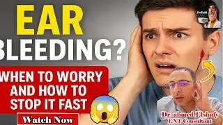 ⭐Simple First Aid Tips for Ear Bleeding at Home! | ProHealthConsults