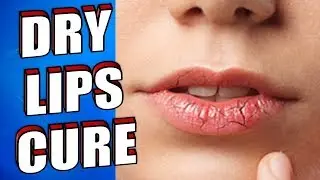 DRY LIPS Fast Cure: Best Natural Treatment for DRY LIPS using a LIP BALM