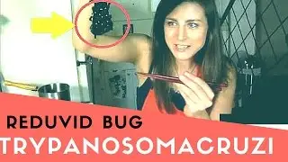 Trypanosoma Cruzi Trypanosoma Bruzi Sleeping Sickness Chagas disease Reduviid Bug - USMLE