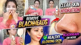 remove blackheads | healthy glowing clear skin | zartasha |