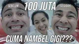 RAFFI GIGI BENERIN GIGI RATUSAN JUTA!!!