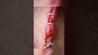 Как заживает рана после швов🤕 zackdfilms - video creator