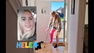 Long Leg Cast