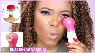 BLACKHEAD PORE VACUUM SUCTION (DOES IT WORK?! TESTING! TESTING!!) | OMABELLETV