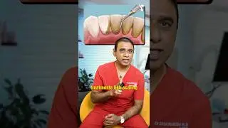 Gum recession is common 🦷, but it can be treated ✅. Watch the reel to know the cause and solution