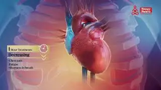 EECP - Advance Heart Treatment For Heart Blockage