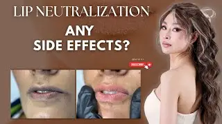 Side Effect of Dark & Pigmented Lip Neutralization in Auckland