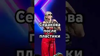 Анна Седакова после пластической операции! / #Шантарам / Москва / Депо три вокзала / 28.10.2023