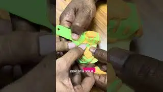 open tray impression for dental implant prosthesis making